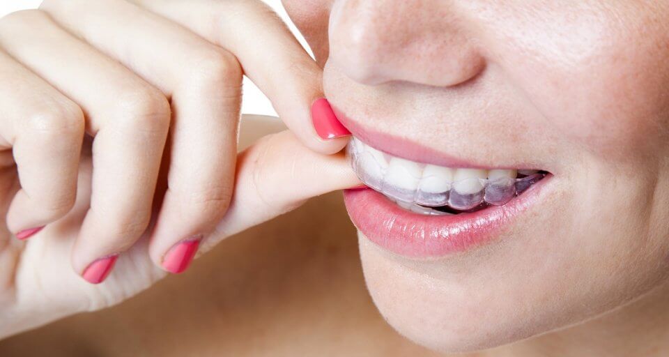 How to Make DIY Braces Out of Dental Floss?