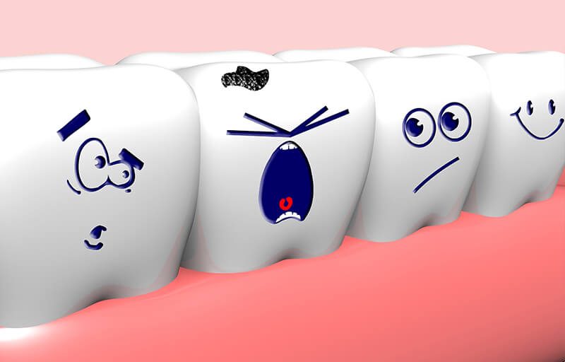 How Do Dentists Treat Tooth Decay?