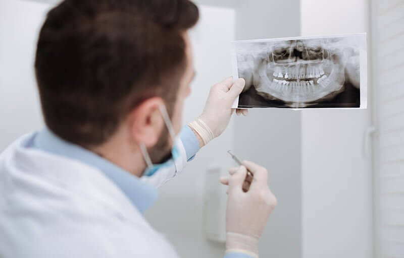 Types of Dental X-Rays and How Often You Need Them